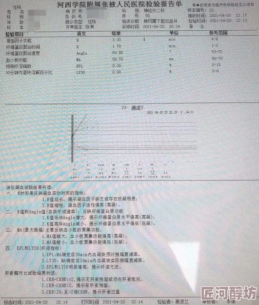 palipali轻量版线路检测线路优化升级访问速度提升体验更流畅